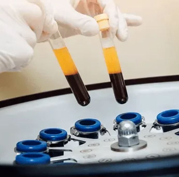 PRF — Fibrina Rica em Plaquetas